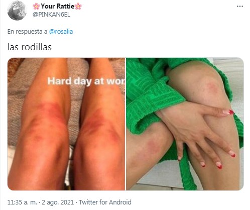 Rosalía en bata de baño luce sexy pero sus fans se fijan en dedos, rodillas y más